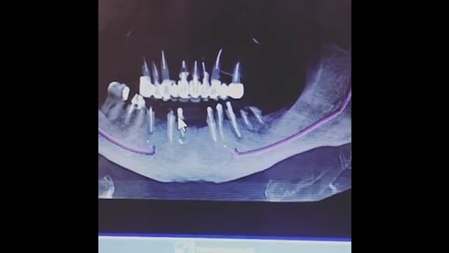 HD порно 173247